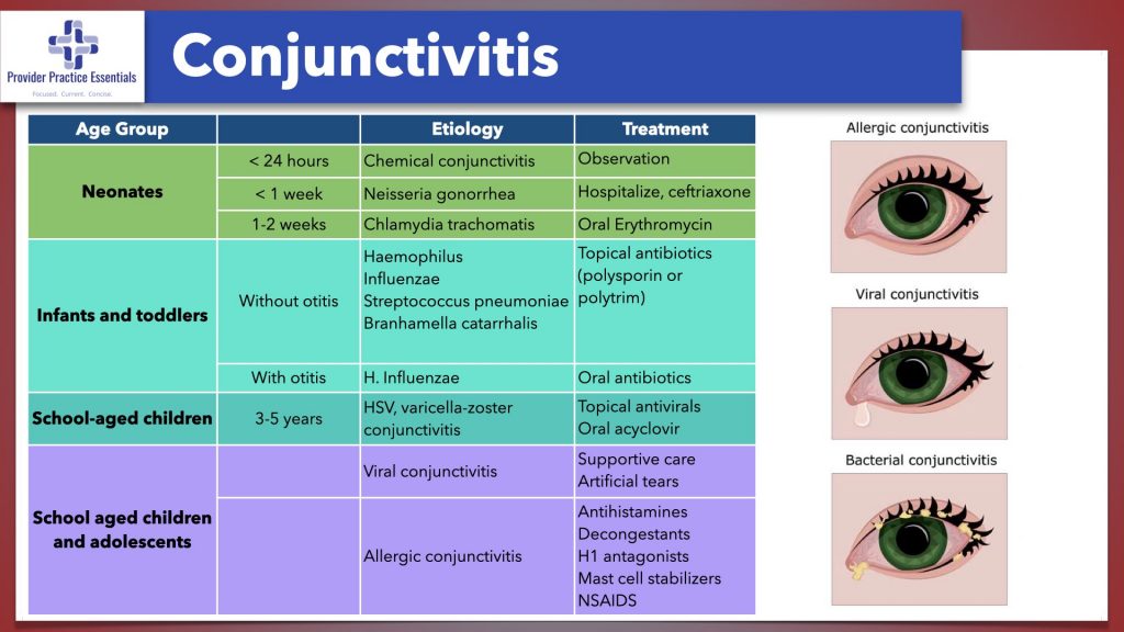 Conjunctivitis Viral Vs Bacterial Conjunctivitis Viral Vs Bacterial