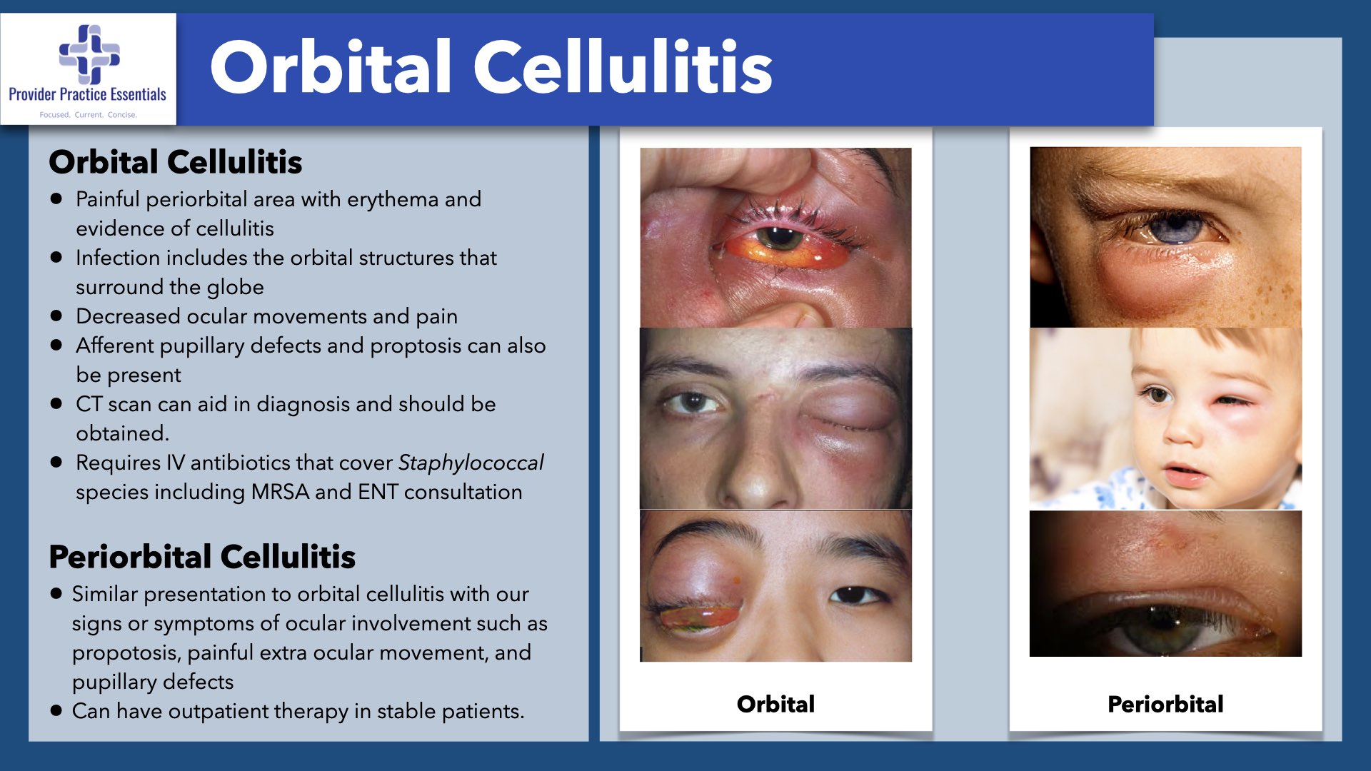 Cellulitis Symptoms Cellulitis Symptoms