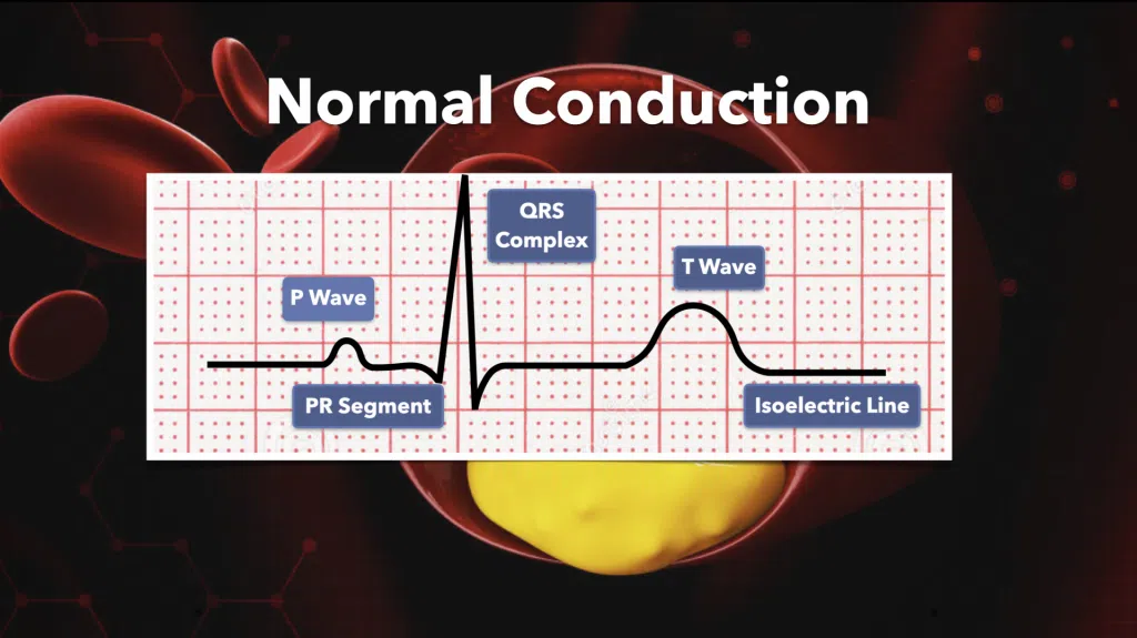 Normal Cardiac Conduction