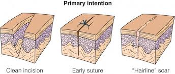 How to Identify and Repair a Laceration Like a Professional