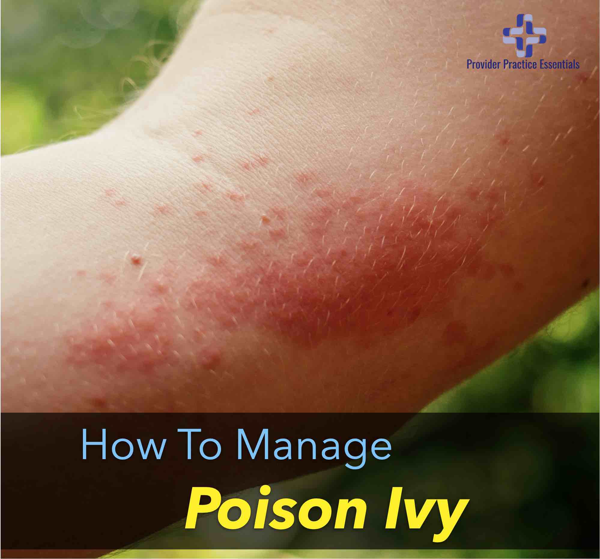 Other Names For Poison Ivy Dermatitis