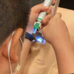Intubation and Laryngoscopy
